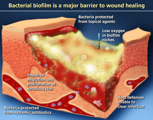 How to tell if a wound is healing or infected