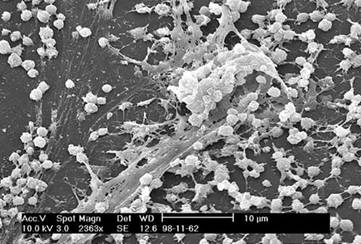 EM of dried biofilm