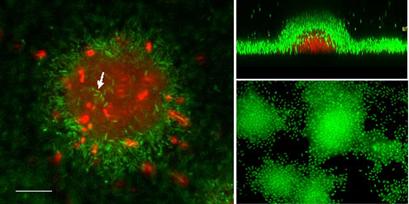 Live/Dead staining in x-y and x-z aspect of a biofilm microcolony.