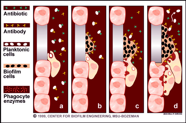 Medical Biofilm Diagram