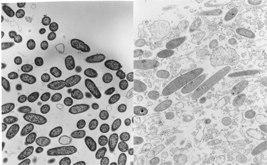 TEM of P. aeruginosa Colony Biofilm