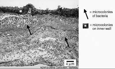 Figure 1. Electron microscopy image of biofilm cross section.