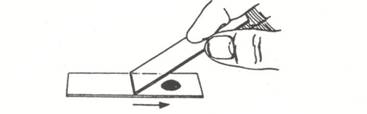 First step in procedure for making a nigrosine smear.