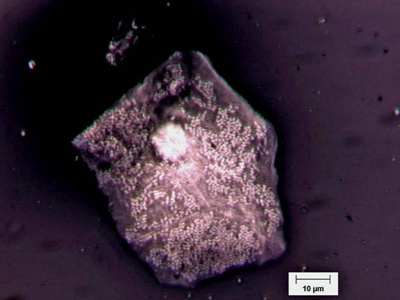 A squamous epitelial stained with nigrosine