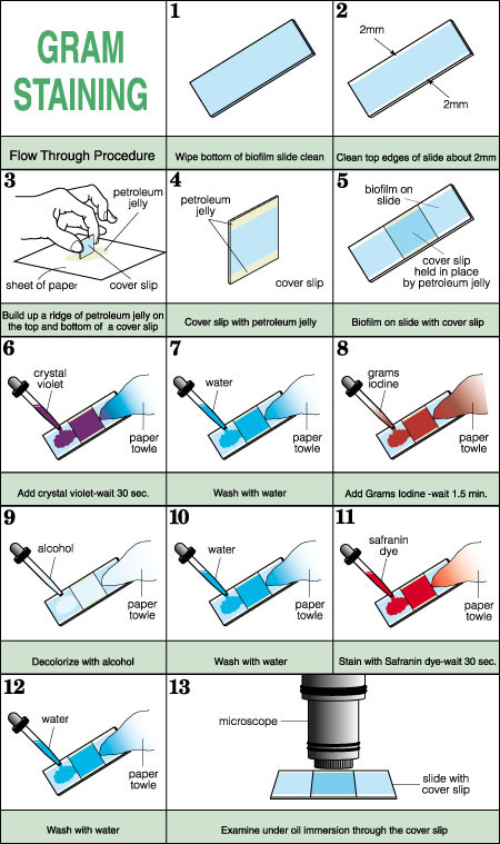 Figure 1. Gram staining method.<